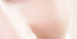 Juvederm