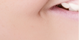 Collagen